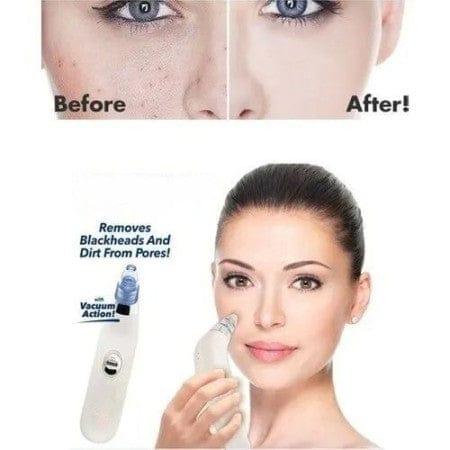 4 in 1 Vaccum Pore Cleaning Device Cell